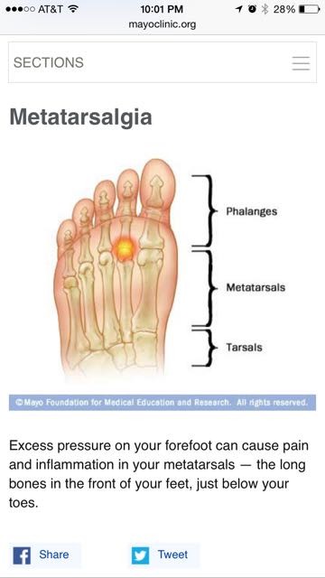 Foot pain diagram 