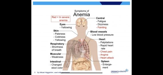 Anemia and IBD