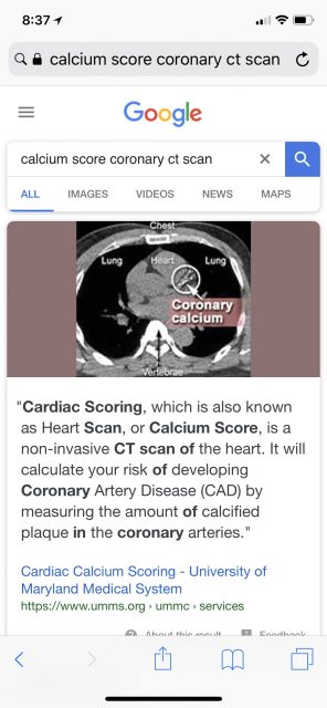 Calcium score Coronary CT scan