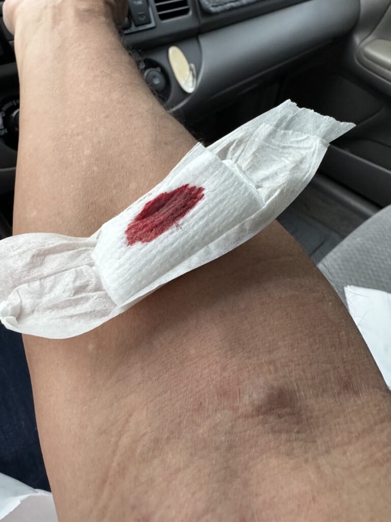 Band aide with drop of blood on it