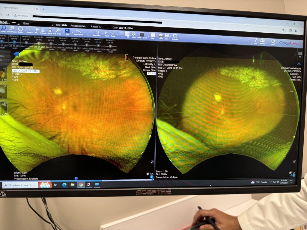 Retina scan