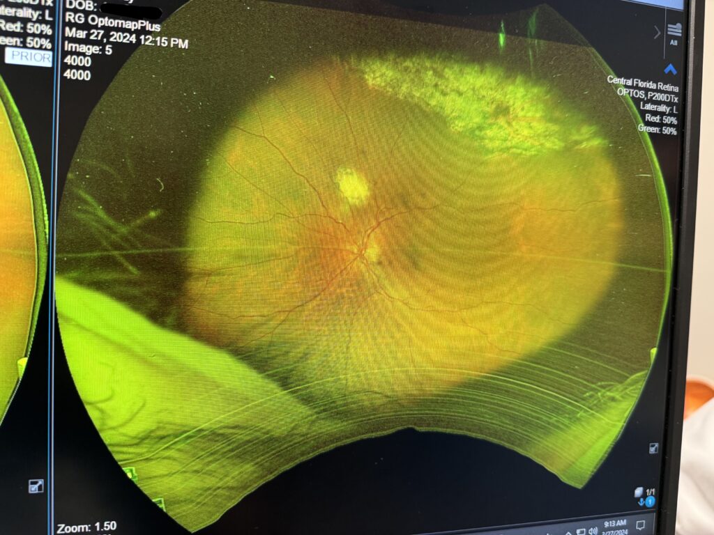 Retina scan