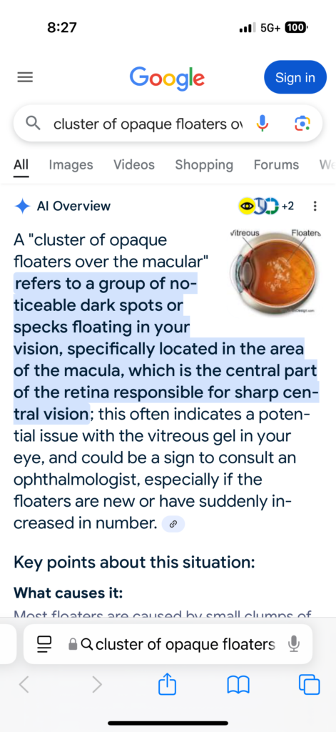 cluster of opaque floaters definition